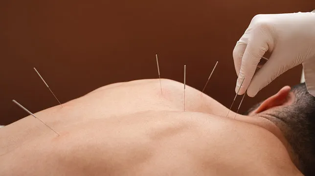 Master Diploma in Acupuncture