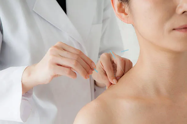Diploma in Acupuncture